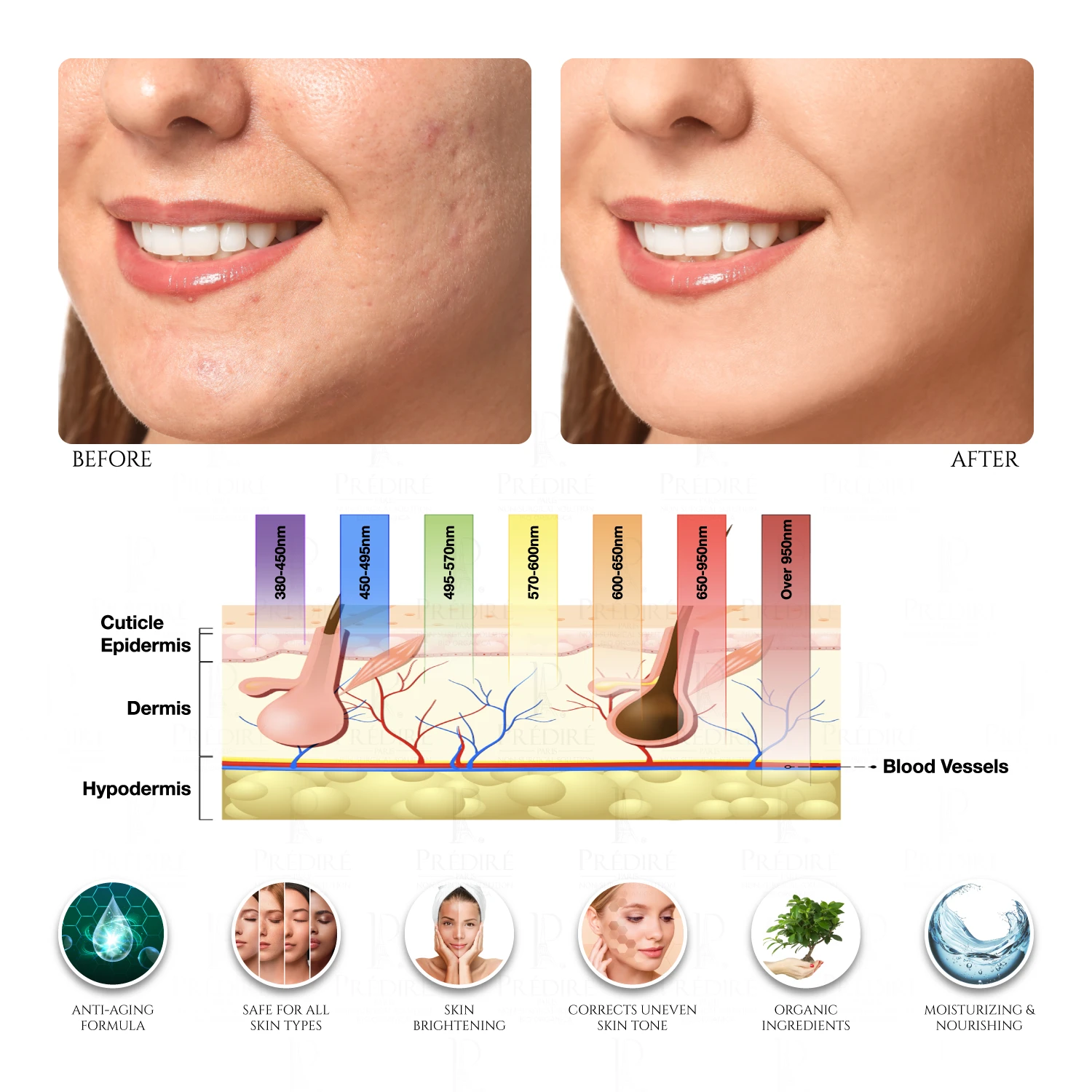 X8 Multi-Purpose LED PHOTON Skincare Mask | Non-Surgical Solution LED Treatment 2 X8 Multi-Purpose LED PHOTON Skincare Mask | Non-Surgical Solution LED Treatment - Image 2