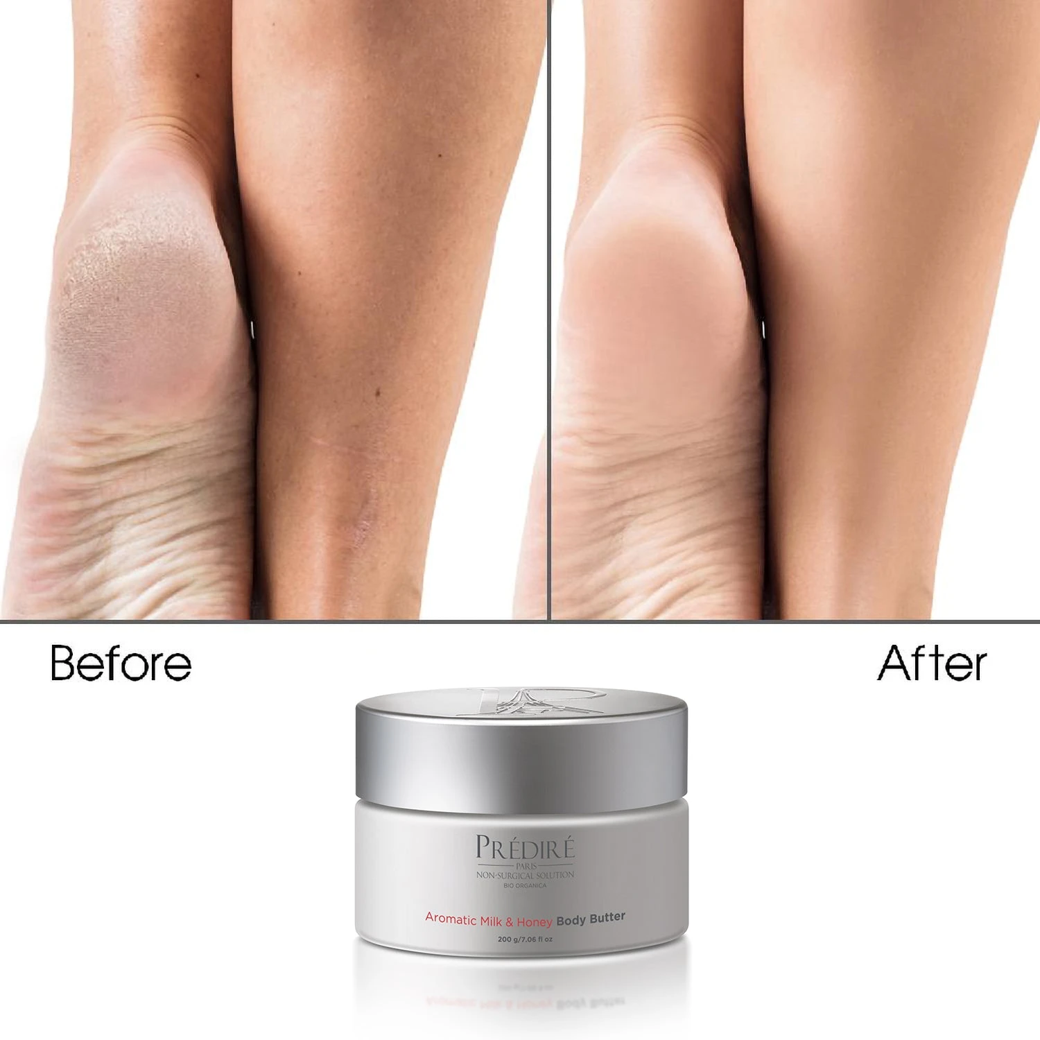 Luxury Body Butter Set 2 Luxury Body Butter Set - Image 2