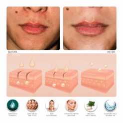 Everyday Care Balancing Facial Complex Cream (Vitamin E & A Booster) -Creed Cheap Shop PG003 ProductImages WATERMARK 02