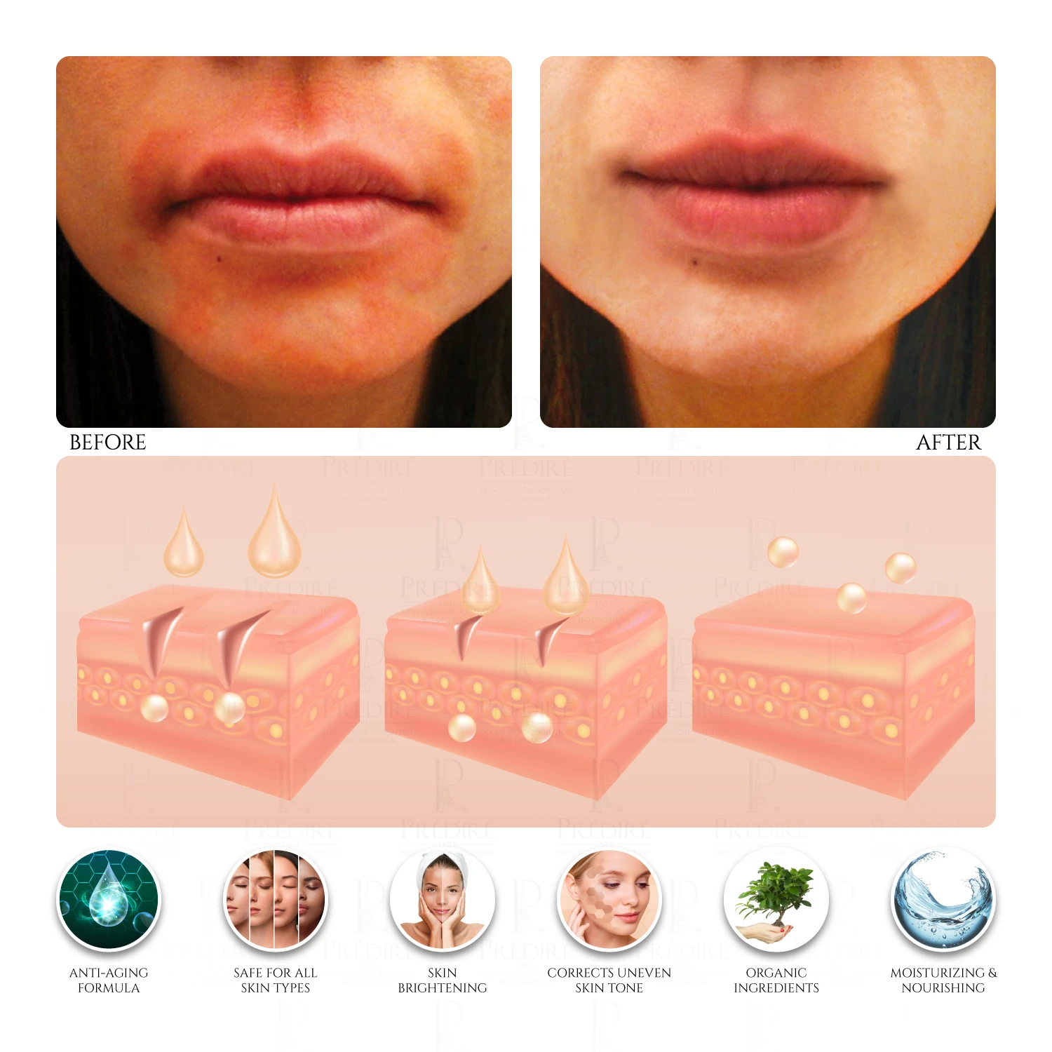 Everyday Care Balancing Facial Complex Cream For Normal To Dry Skin 3 Everyday Care Balancing Facial Complex Cream For Normal To Dry Skin - Image 3