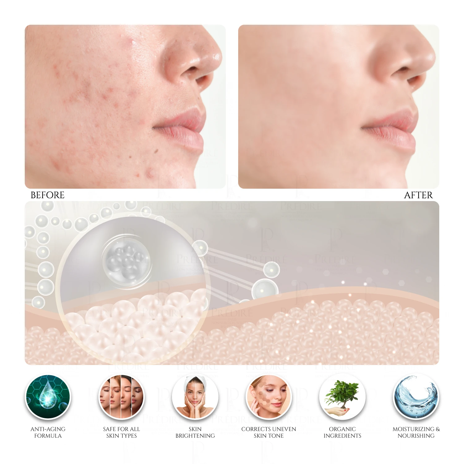 Snail Age-Defying Collection | Concentrate, Serum, Gel, Renewal, Mask, & Toner| Limited Edition 2 Snail Age-Defying Collection | Concentrate, Serum, Gel, Renewal, Mask, & Toner| Limited Edition - Image 2