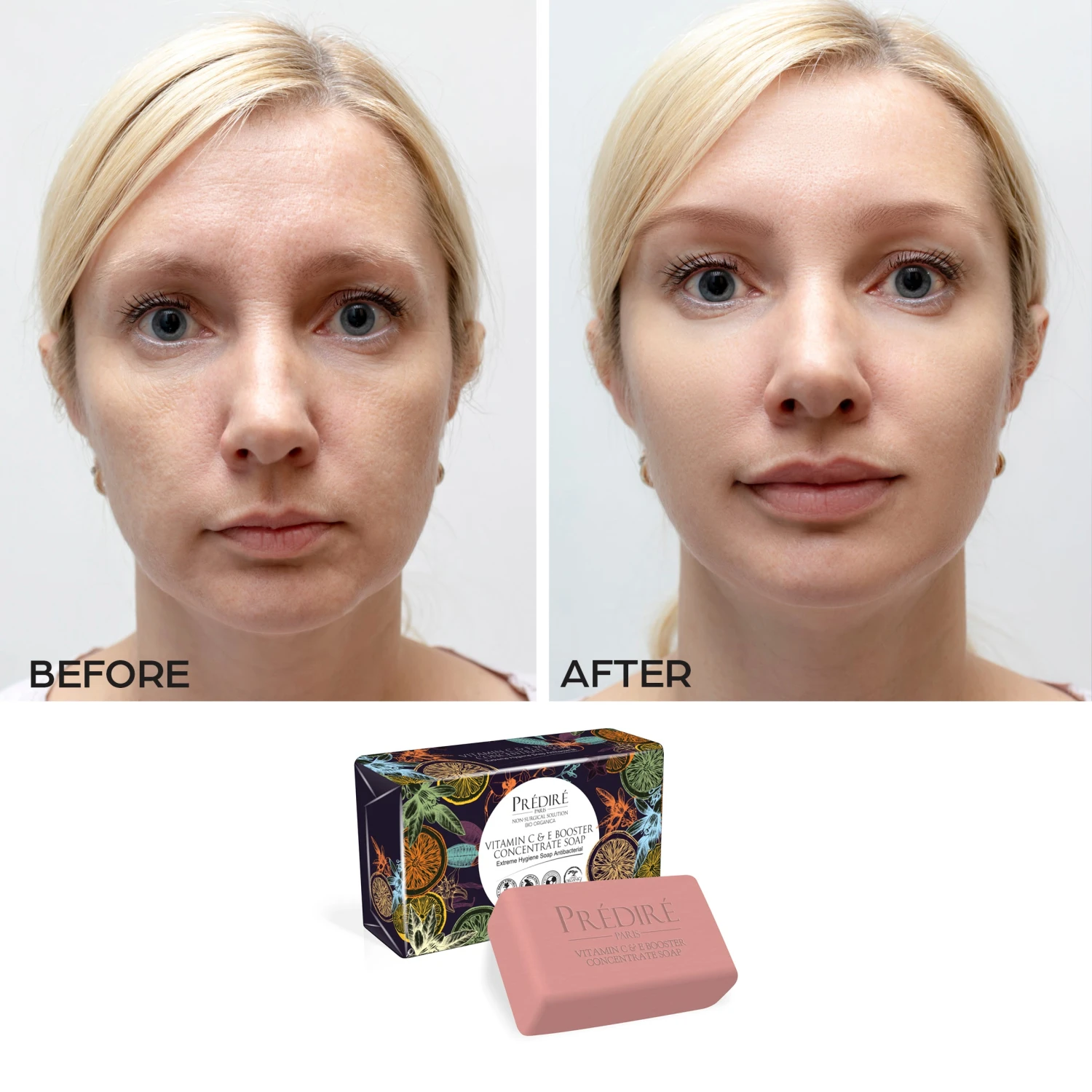 Luxury Soap Collection | Extreme Hygiene Anti-Bacterial Soap - (4 Pack Bundle) 3 Luxury Soap Collection | Extreme Hygiene Anti-Bacterial Soap - (4 Pack Bundle) - Image 3