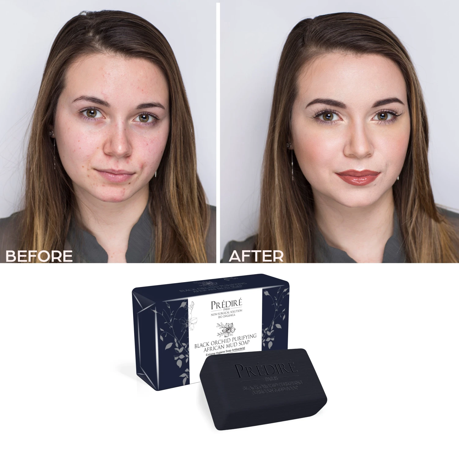 Luxury Soap Collection | Extreme Hygiene Anti-Bacterial Soap - (4 Pack Bundle) 5 Luxury Soap Collection | Extreme Hygiene Anti-Bacterial Soap - (4 Pack Bundle) - Image 5