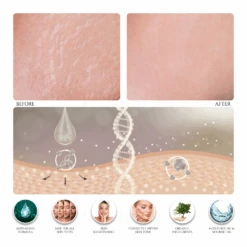 Cellulite Skin Tightening & Tissue Bonding Cream (Rich Vitamin E & Retinol) -Creed Cheap Shop PT002 ProductImages WATERMARK 02